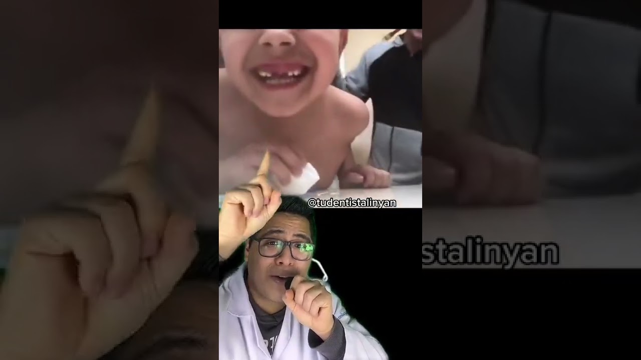 Watch 6 PASOS PARA RETIRAR LOS DIENTES DE LECHE SIN DOLOR 🦷🧑🏻⚕️🎤 Now 6 PASOS PARA RETIRAR LOS DIENTES DE LECHE SIN DOLOR 🦷🧑🏻⚕️🎤