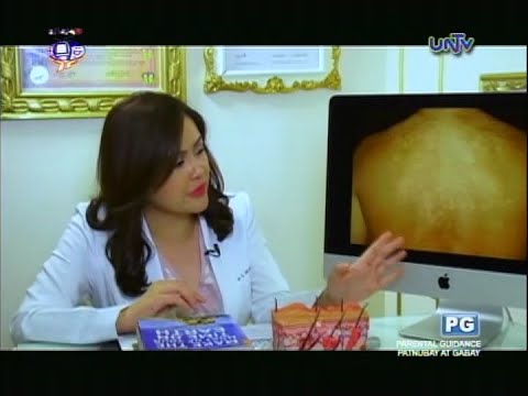 An-an - Tinea/Pityriasis Versicolor [ENG SUB]