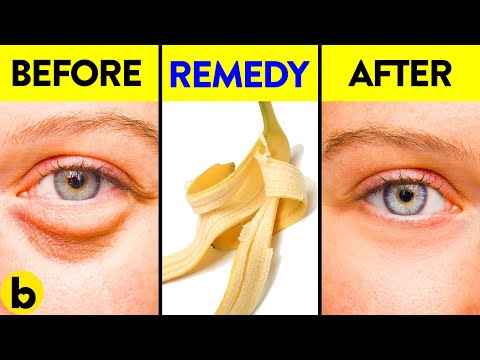 13 Surprising Ways To Use Banana Peels For Everyday Life