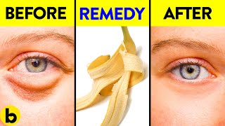 13 Surprising Ways To Use Banana Peels For Everyday Life