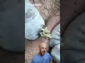 You Aren T Ready For This Cyst And Ingrown Hair Combo Credit Brufoilpimple Doctor Satisfying