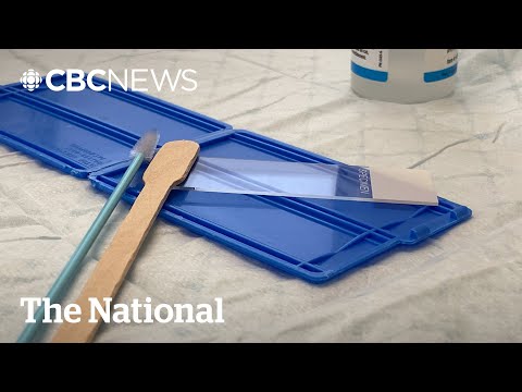 Ontario switches to HPV test for cervical cancer screening