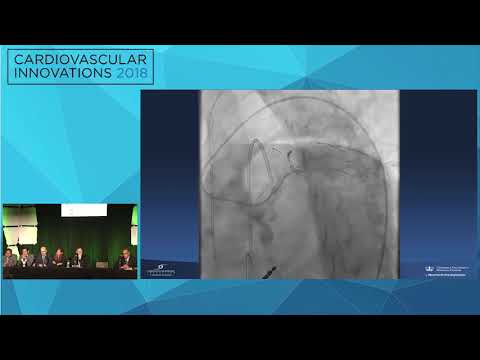 CVI2018 Session: My Best Case of the Year (Mt. Sopris, July 27, 13:30 pm)