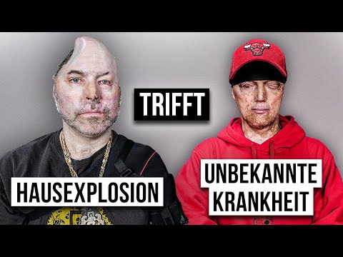 NIKO trifft ELDIN | Das Treffen