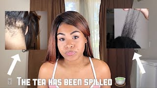 NO MORE DRY &amp; BRITTLE HAIR | Combat Breakage &amp; Dryness!