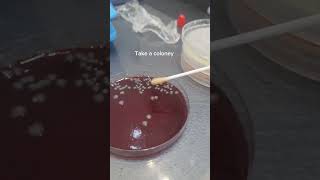 Indole test for E.Coli identification #bacteria #indole #ecoli