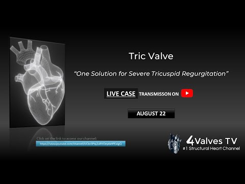 TricValve - "One Solution for Severe Tricuspid Regurgitation" - Live Case from Brazil