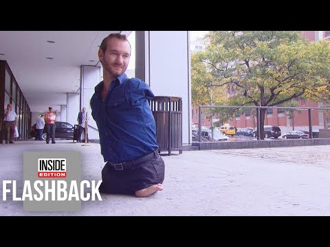 Meet the Inspiring Man Born With No Limbs