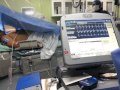 AICD Defibrillation Threshold Test