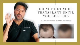 Canadian Hair Transplant Centre