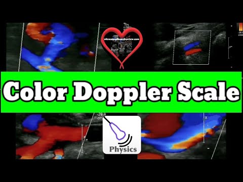 Understanding Color Doppler Scale in Ultrasound
