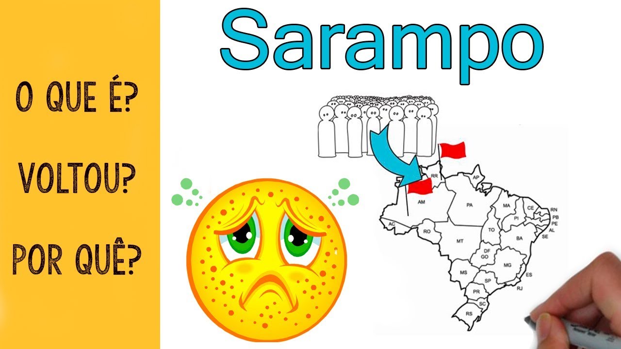 O Sarampo voltou? O que você deve saber | RESUMÃO