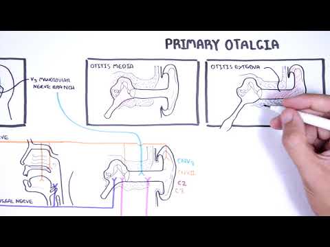 Neonatal Infections Overview