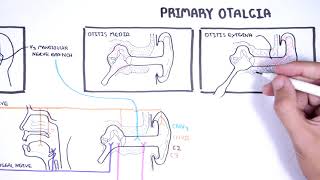 Understanding Ear Pain - Otalgia (Innervation of ear, mechanism of ear pain and causes)