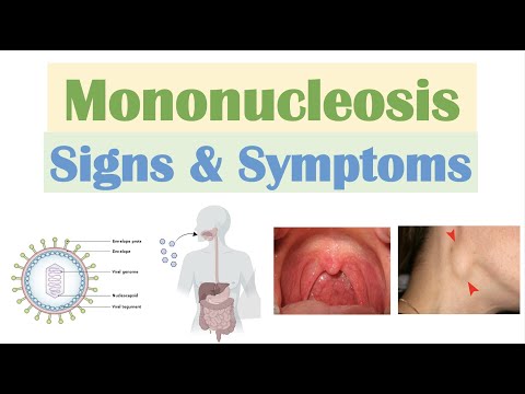 Infectious Mononucleosis (Mono) Signs & Symptoms