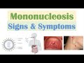 Infectious Mononucleosis (Mono) Signs & Symptoms