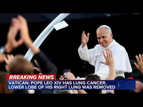Pope Leo XIV has lung cancer, Vatican says