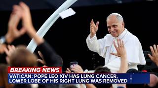 Pope Leo XIV has lung cancer, Vatican says