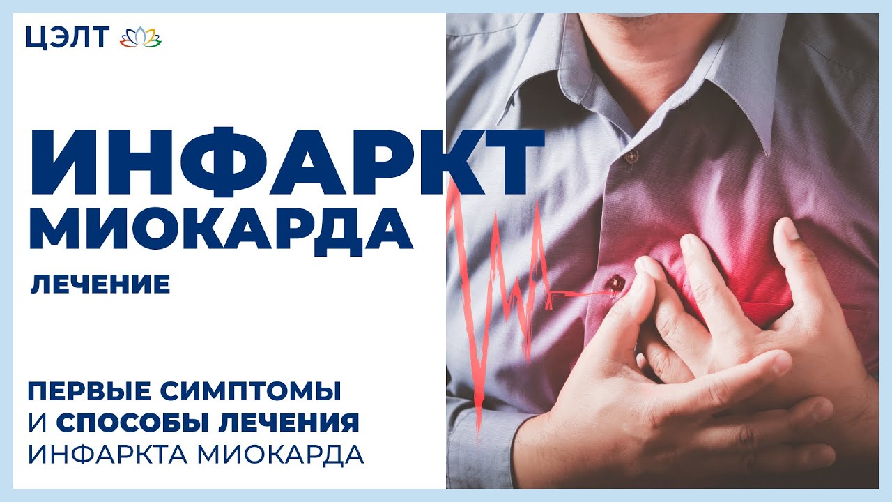 Предынфарктное состояние лекарства. Стабильная атеросклеротическая бляшка. Предынфарктное состояние симптомы. Предынфарктные симптомы. Предынфарктная кардиограмма.