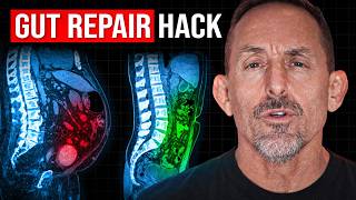 Download lagu This Weird Japanese Healing Hack Fixes Leaky Gut Forever mp3 Download lagu This Weird Japanese Healing Hack Fixes Leaky Gut Forever mp3