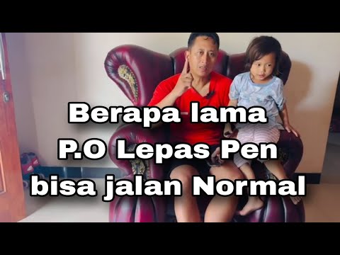 SESSION 16: Tips for walking normally P.O. Remove the Tibia Fibula Fracture Pin