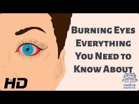 Burning Eyes: Everything You Need to Know