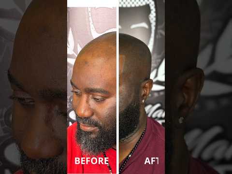 So we’re TATTOOING FADES now? 🤯😎 #scalpmicropigmentation #smp