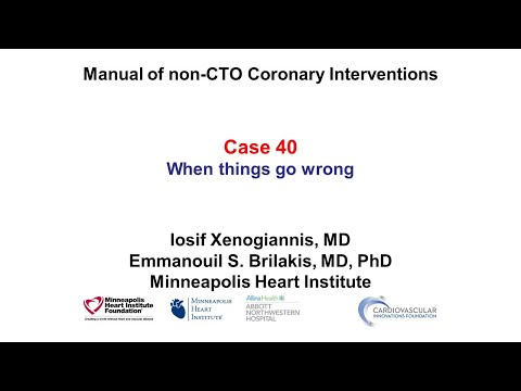 Case 40: PCI Manual - When everything goes wrong
