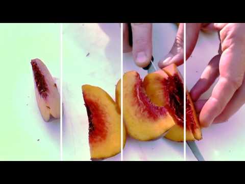 Brisbane Health (31 Digital TV series): Opener