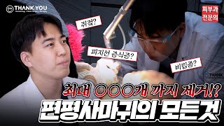 편평사마귀에 대해 전부 알려드립니다