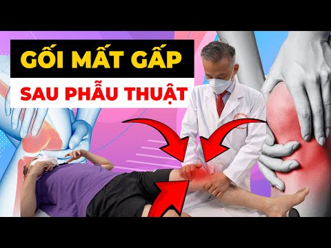 Tại Sao Gối Lại Cứng Sau Phẫu Thuật? Bí Quyết Từ Chuyên Gia Để Khắc Phục