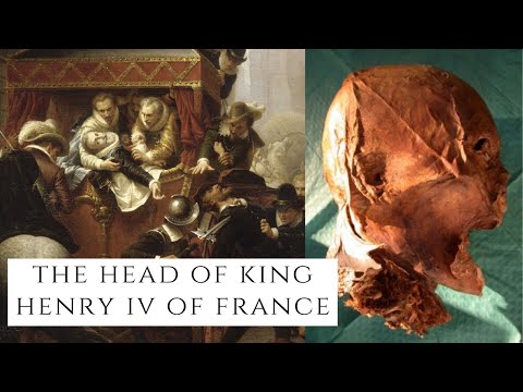 The Head Of King Henry IV Of France