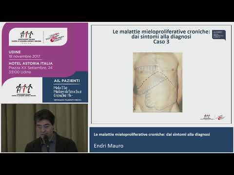Lentiggine vacanze da bambini Mosca Il pigmentary nota su una faccia e il loro trattamento