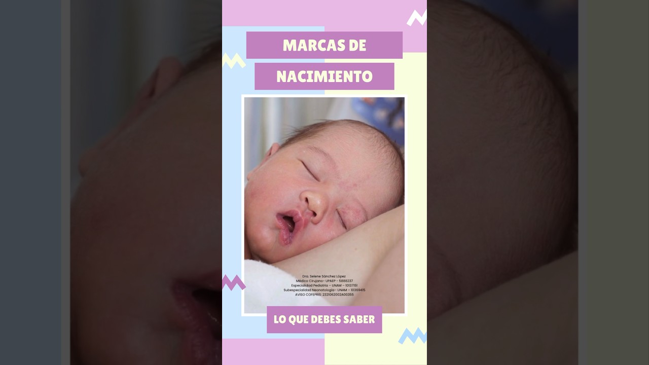Marcas de nacimiento #maternidad #tipsparamamas