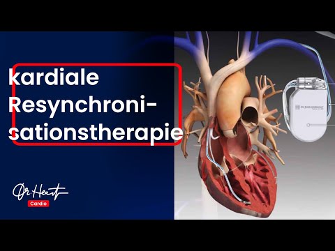 Besser leben mit Herzschwäche! Die Kardiale Resynchronisationstherapie (CRT) | Dr. Heart