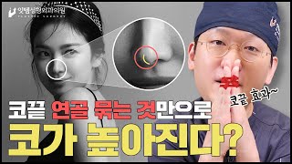 코수술 대신 코끝연골만 묶으면?! 코끝연골묶기만으로 드라마틱한 효과가 있는 사람도 있다!