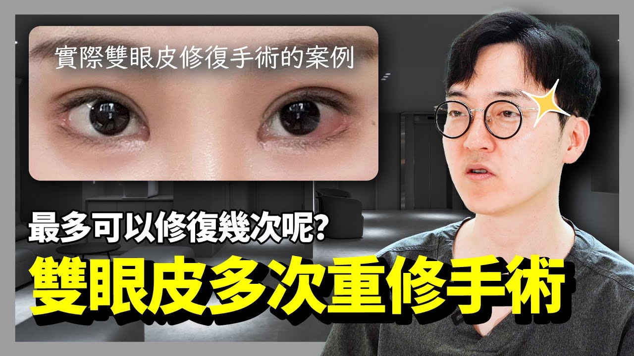 雙眼皮不滿意？雙眼皮重修手術讓你煥然一新