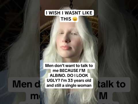It’s hard being ugly & albino…😓 #lonelygirl #albino #livingalone #datingover50