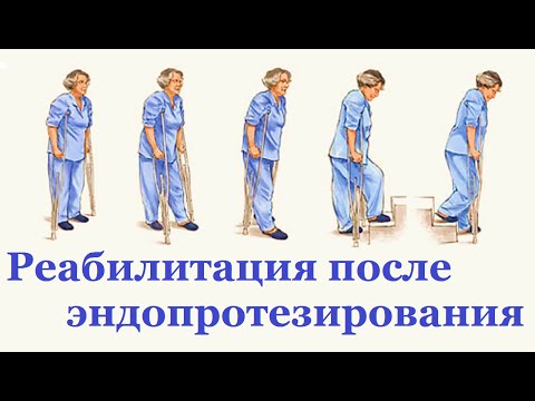Остеохондроз с одной стороны Врач который лечит кости и суставы это