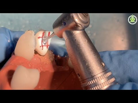 Stomatologia przedkliniczna - dostęp endodontyczny w odcinku przednim