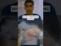 Gynecomastia Pinch Test At Home Gynecomastia Dranmolchugh