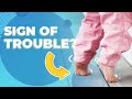 The Truth About Toe Walking Dangers Parents Need To Know About