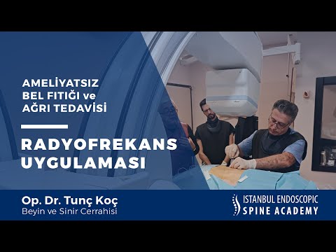 Radyofrekans Ameliyatsız Fıtık ve Ağrı Tedavisi Video