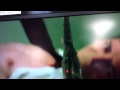 Navel Scourge