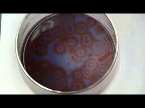 Belousov--Zhabotinsky Reaction