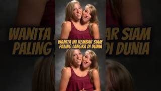 Download lagu The Rarest Conjoined Twins in the World: Abigail and Brittany Hensel 😱 #truestory mp3 Download lagu The Rarest Conjoined Twins in the World: Abigail and Brittany Hensel 😱 #truestory mp3