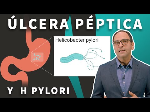 Peptic ulcer disease and H. pylori infection: Stanford
