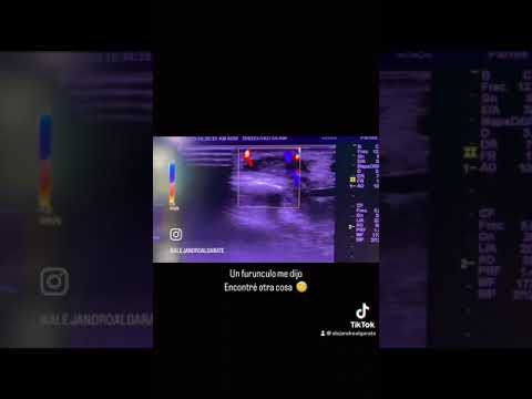 Alejandro Martin Algarate Casanatan-6