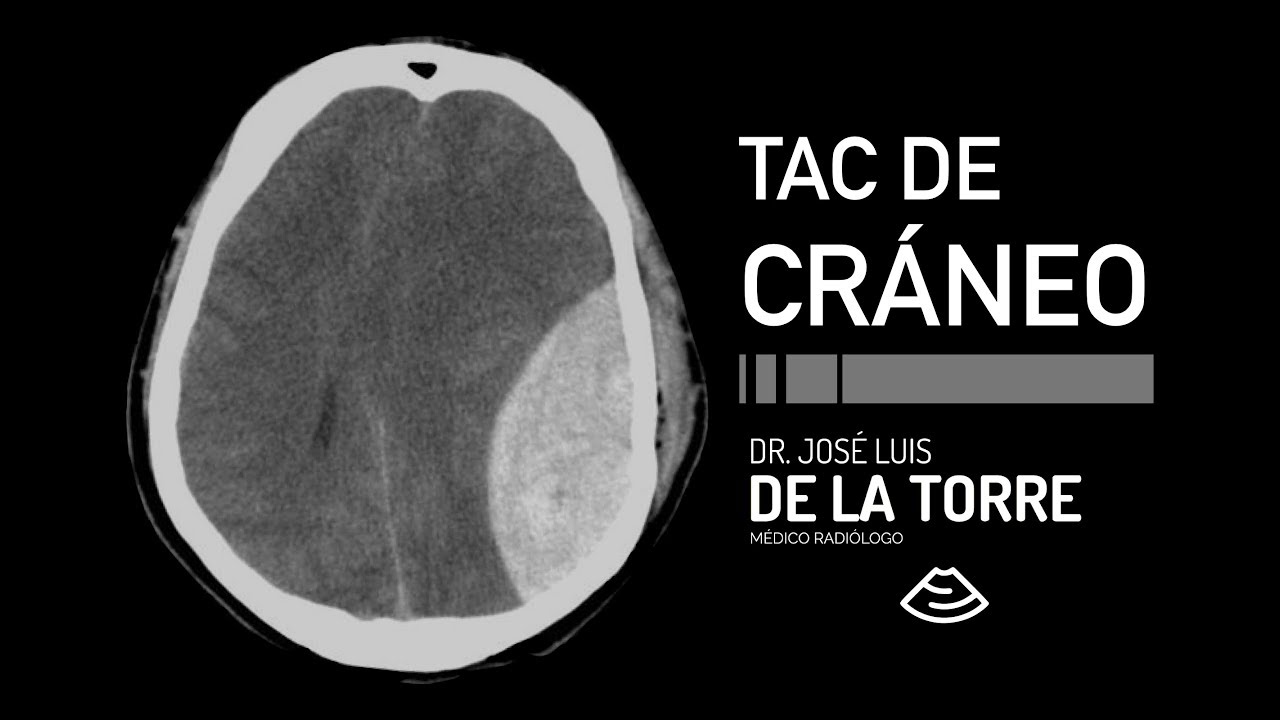 José Luis De La Torre Gastélum-19