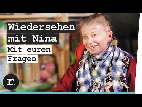 Die nicht hormonalen Salben beim Ekzem auf den Händen Ist von der Schuppenflechte ermüdet